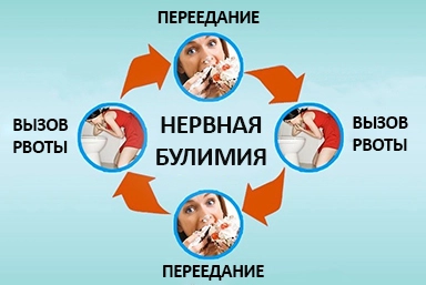 Лечение булимии в Иркутске